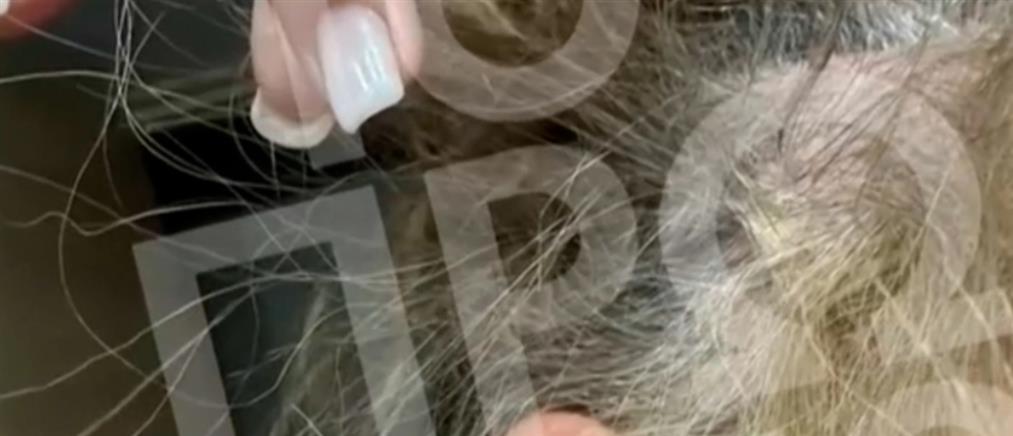 "Το Πρωινό": 43χρονη καταγγέλλει ότι έπεσε θύμα ξυλοδαρμού στη μέση του δρόμου από γνωστό πλαστικό χειρούργο (βίντεο)