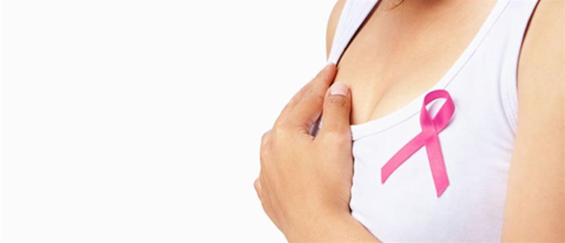 Καρκίνος μαστού: Που οφείλεται η μείωση της θνητότητας;