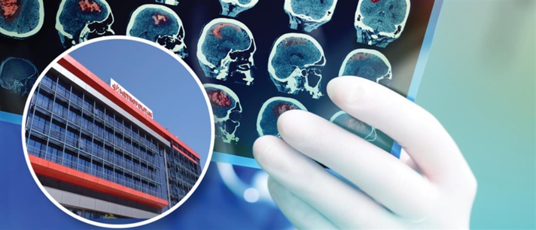 Metropolitan Hospital: Τεχνητή νοημοσύνη για αντιμετώπιση εγκεφαλικών επεισοδίων
