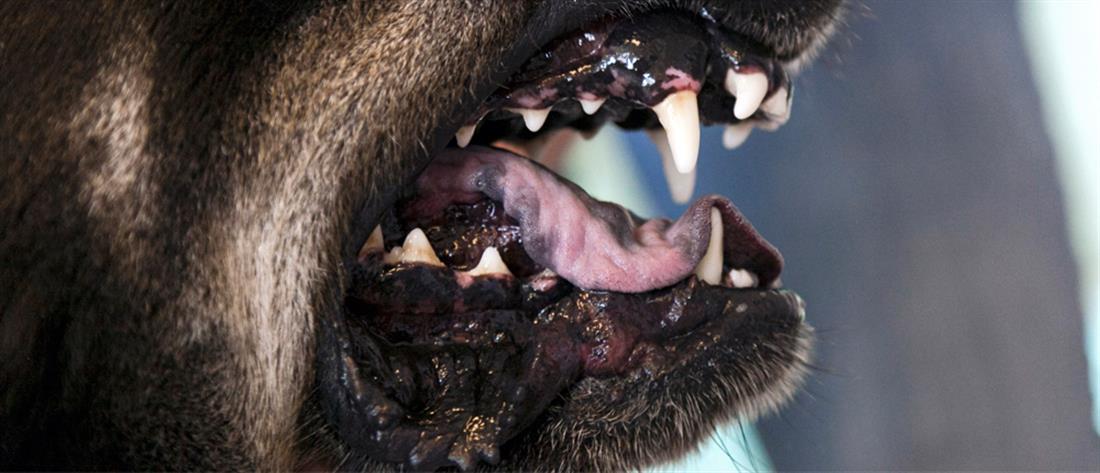 Φθιώτιδα: Αδέσποτα σκυλιά δάγκωσαν παιδάκι (εικόνες)