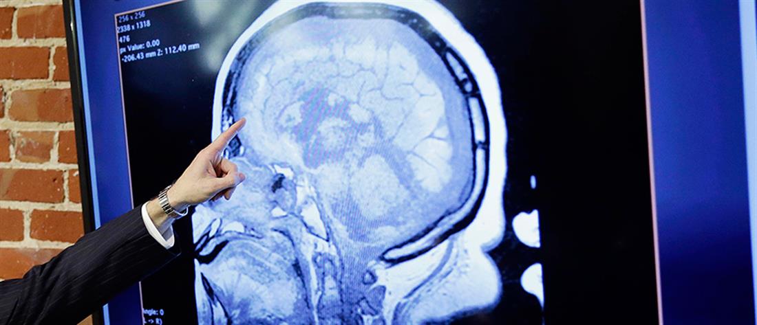 Τεχνητή σύναψη εγκεφάλου επικοινωνεί με τα εγκεφαλικά κύτταρα