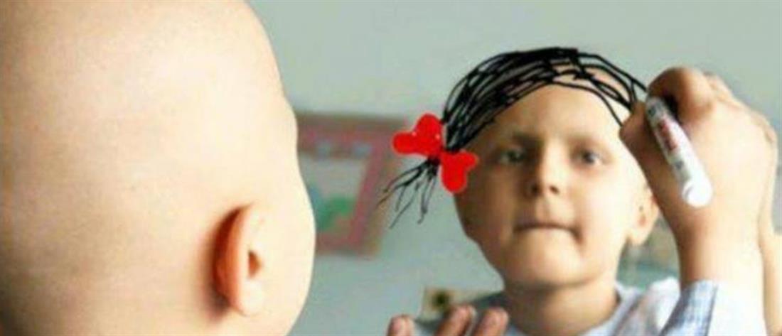 Καρκίνος στην παιδική ηλικία: ανεπιθύμητες ενέργειες της χημειοθεραπείας