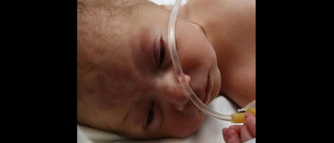 Γάζα: Παλαιστίνια έγκυος πέθανε σε βομβαρδισμό, γιατροί έβγαλαν σώο το βρέφος από την κοιλιά της (βίντεο)