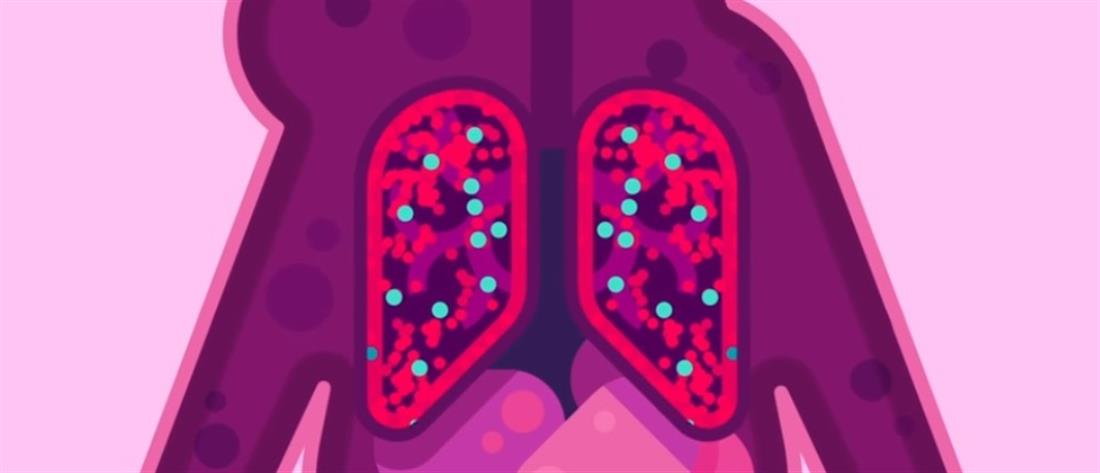 COVID-19 και προϋπάρχοντα αναπνευστικά νοσήματα: Τι πρέπει να προσέχουν οι ασθενείς;
