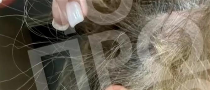 "Το Πρωινό": 43χρονη καταγγέλλει ότι έπεσε θύμα ξυλοδαρμού στη μέση του δρόμου από γνωστό πλαστικό χειρούργο (βίντεο)