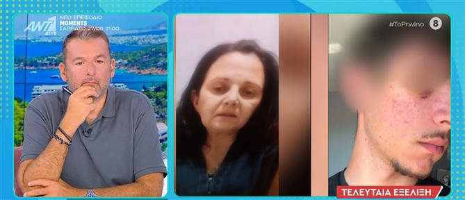 "Το Πρωινό": Άγριος ξυλοδαρμός ανηλίκου στα Τρίκαλα με αφορμή τα ρούχα του