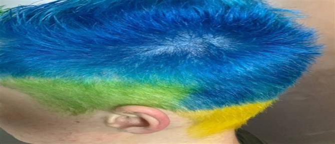 Ρωσία: Πρόστιμο σε άνδρα επειδή έβαψε τα μαλλιά του στα χρώματα της Ουκρανίας