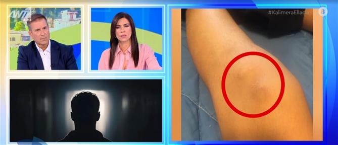 Καλημέρα Ελλάδα - Επίθεση Μοσχάτο: Συγκλονίζει ο πατέρας του 13χρονου: Συνεχίζουν να κοροϊδεύουν το παιδί, δε ζήτησε κανείς συγγνώμη