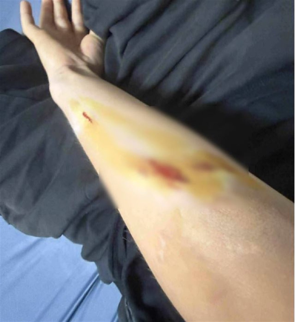 Σκύλος - Μεσαρά