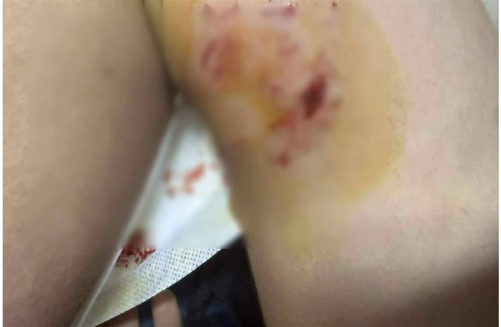 Σκύλος - Μεσαρά