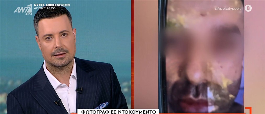 "Αποκαλύψεις" - Καλαμάτα: Με σύστημα εντοπισμού και κοριούς είχε παγιδεύσει ο 41χρονος δράστης τη σύζυγό του