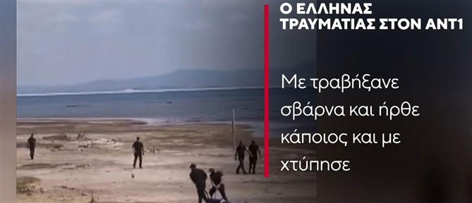 Άγρια επεισόδια στην Αλβανία: "Μου έβγαλαν όπλο, με χτυπούσαν" λέει ο  Έλληνας τραυματίας  στον ΑΝΤ1