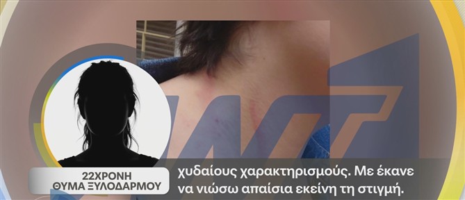 Παγκράτι - Το 22χρονο θύμα ξυλοδαρμού στο "Καλημέρα Ελλάδα": Άρχισε να με βρίζει χυδαία...Με πιάνει από το κολάρο και μου ρίχνει μπουνιά